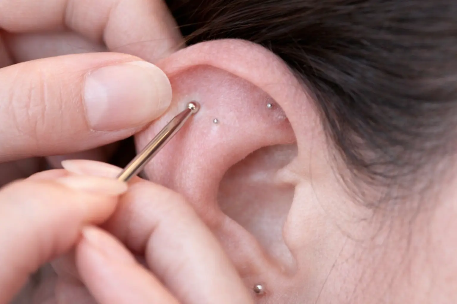 Auriculoterapia en Medicina Tradicional China