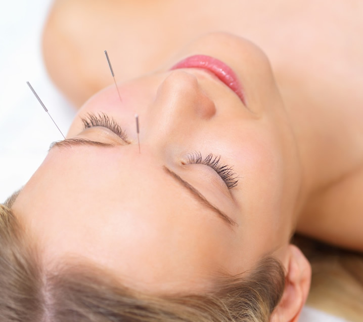 Acupuntura estética facial