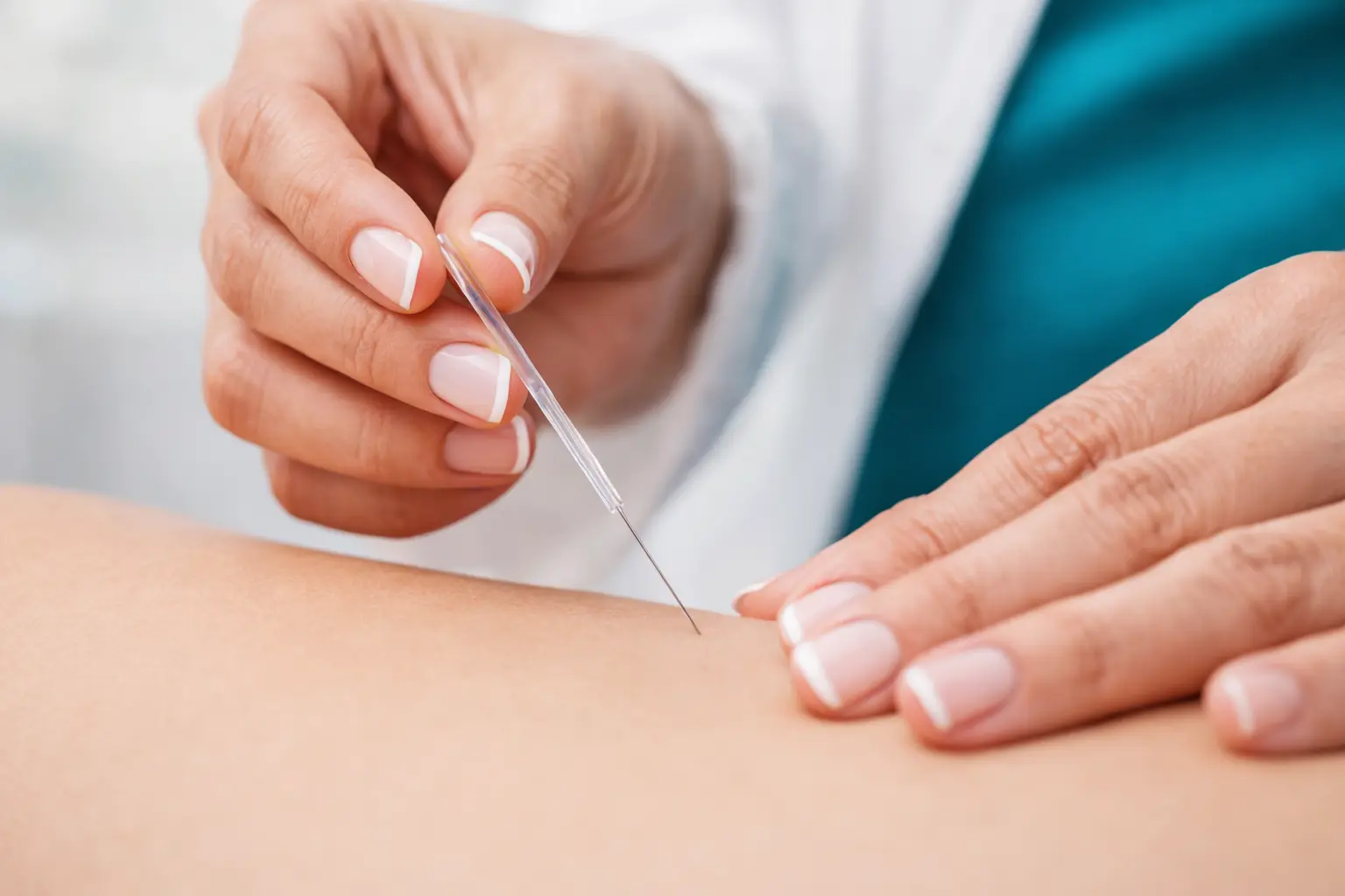 Acutomología en MTCh